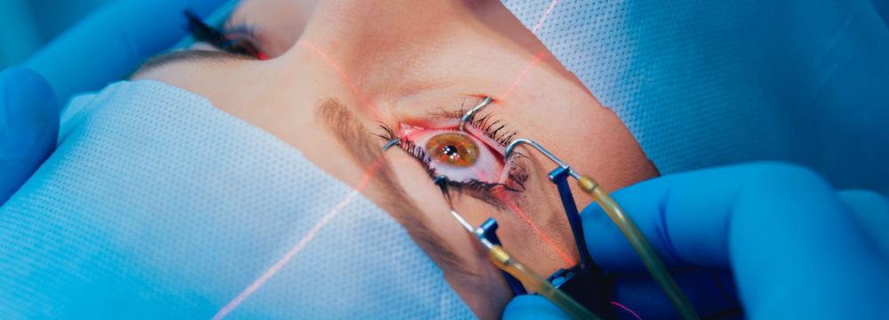 Laserové operace očí: jsou oblíbené, přesto se nehodí pro každého