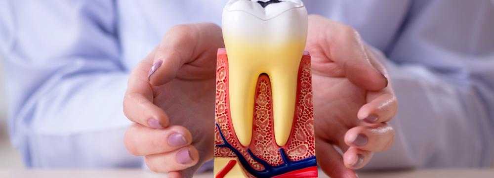 Trápí vás zánět dásní, zápach z úst a citlivé zuby? Poradíme vám, jak na léčbu a prevenci