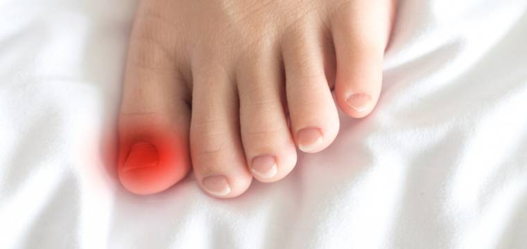 Onemocnění a problémy, které může signalizovat bolest palce u nohy