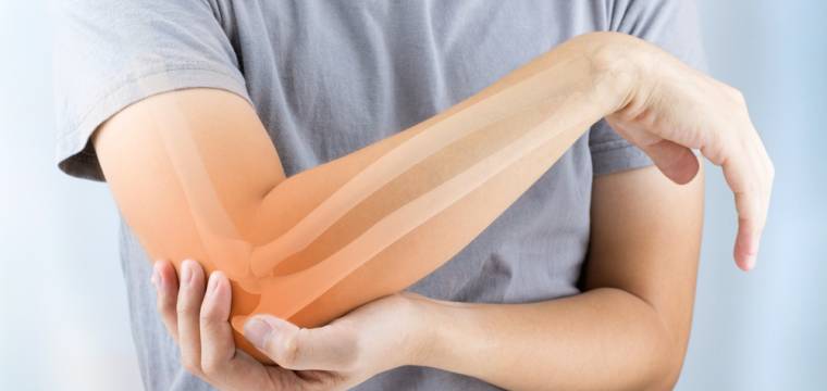Osteoporóza: komu hrozí nejvíce a jak se před ní chránit?