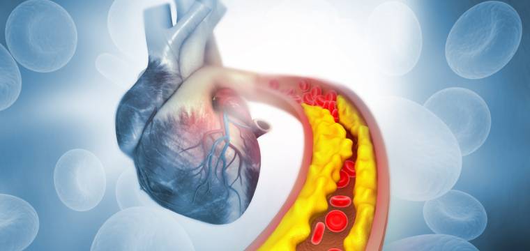 Strašák cholesterol: kdy můžete zachovat klid a kdy se začít bát?