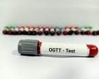Strašák těhotných: orální glukózový toleranční test oGTT. Jak jej zvládnout v klidu a v pohodě?