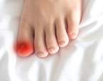 Onemocnění a problémy, které může signalizovat bolest palce u nohy