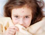 Jedno z nejčastějších dětských onemocnění vás může v dospělosti ohrozit