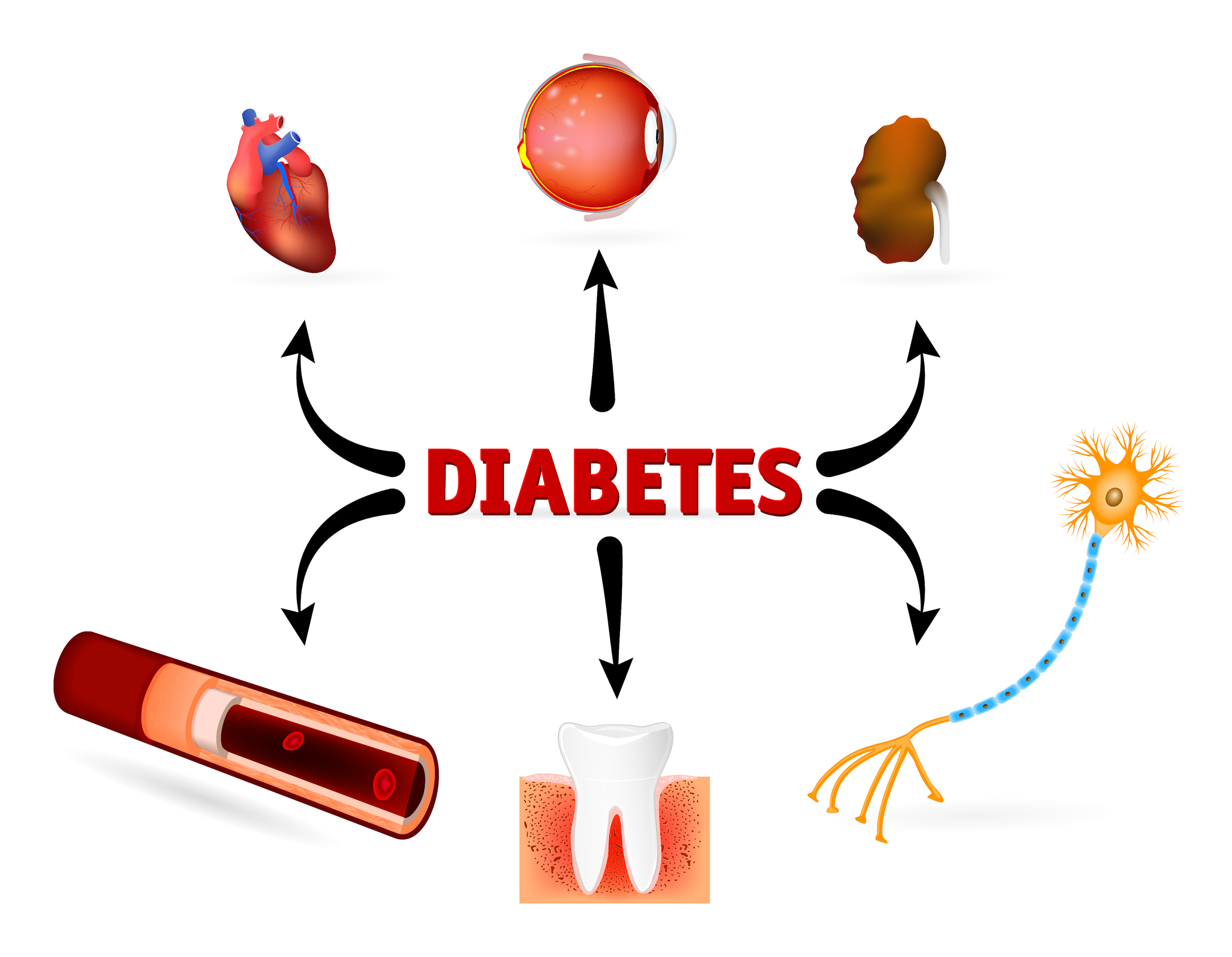 Fogyatékosság magas vérnyomással és cukorbetegséggel